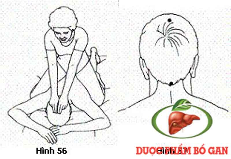 cach-tri-dau-dau-khi-uong-ruou-bang-huyet-bach-hoi